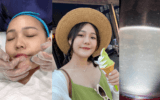 2023Dcard最夯醫美海菲秀水飛梭是什麼？無痛除粉刺、肌膚亮白2階！水飛梭初體驗分享