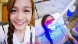 台中牙齒美白推薦｜Ｄr.Min美齒專家｜15分鐘亮白牙齒。溫和漸進式的冷光美白