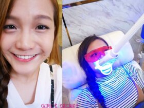 台中牙齒美白推薦｜Ｄr.Min美齒專家｜15分鐘亮白牙齒。溫和漸進式的冷光美白